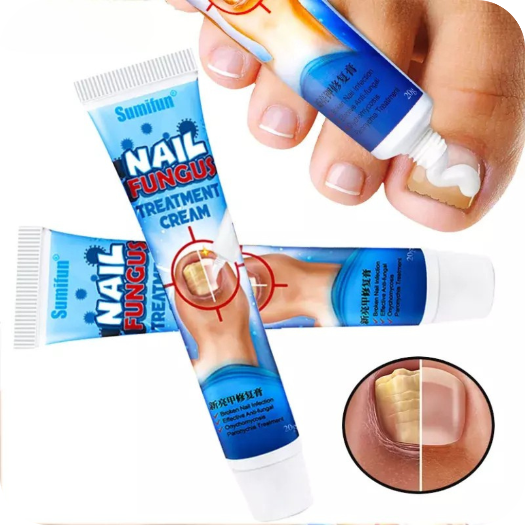 Nail Fungus Pro® Crema Anti Hongos para los Pies