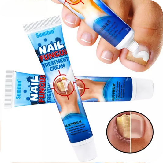 Nail Fungus Pro® Crema Anti Hongos para los Pies