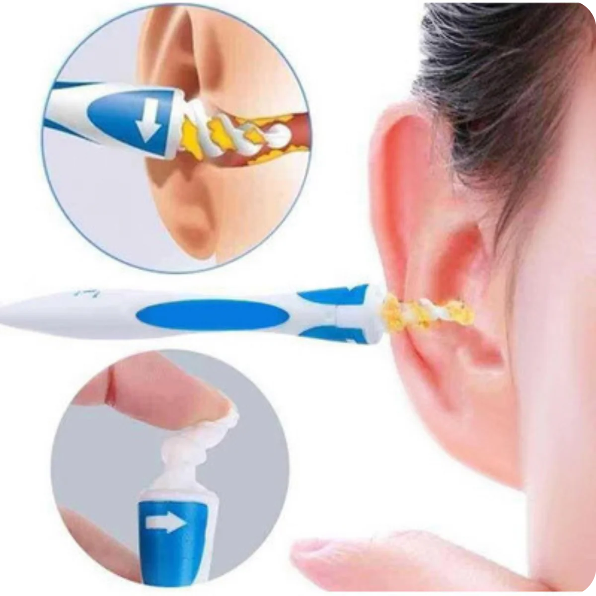 FindPro Removal® Removedor de Cera de Oídos