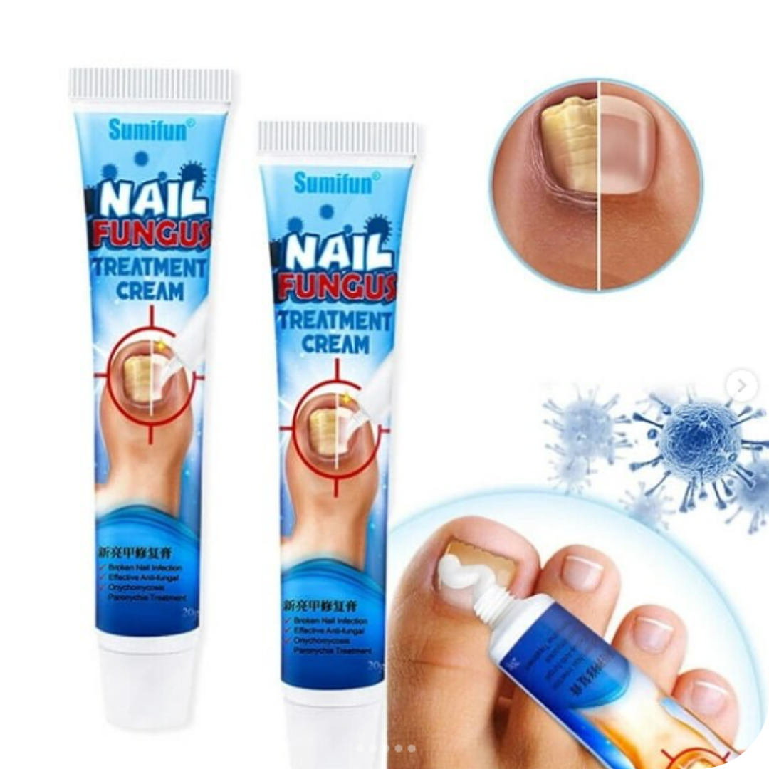 Nail Fungus Pro® Crema Anti Hongos para los Pies