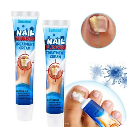 Nail Fungus Pro® Crema Anti Hongos para los Pies