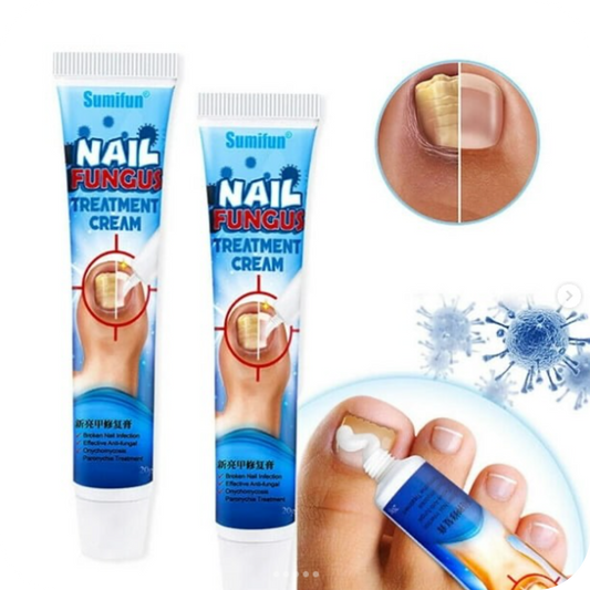 Nail Fungus Pro® Crema Anti Hongos para los Pies